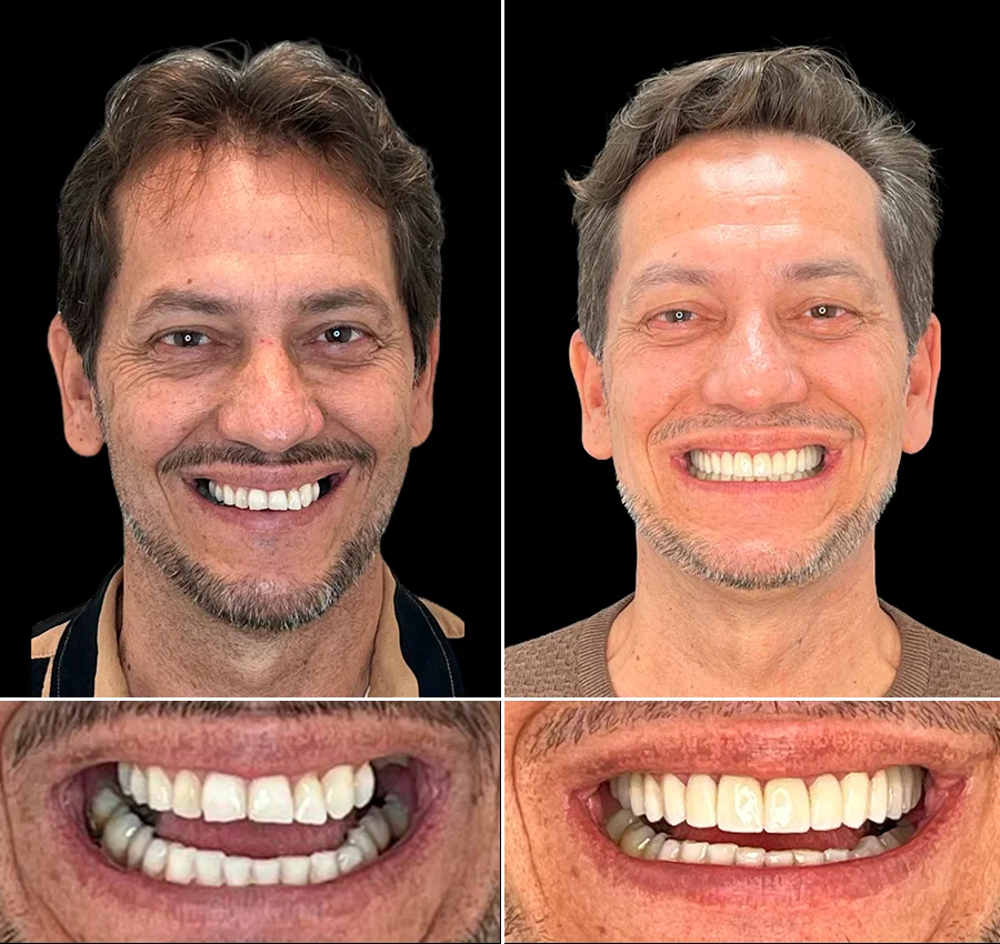 Cuide da sua vitalidade começando pelo sorriso: Encontre seu dentista em Brasília