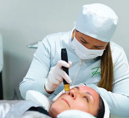 Microagulhamento Facial