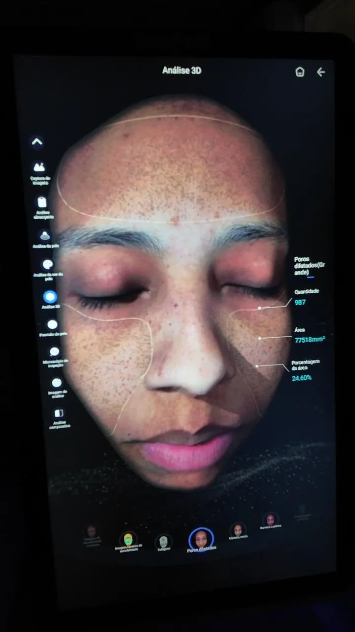 Avaliação 3D e escaneamento facial