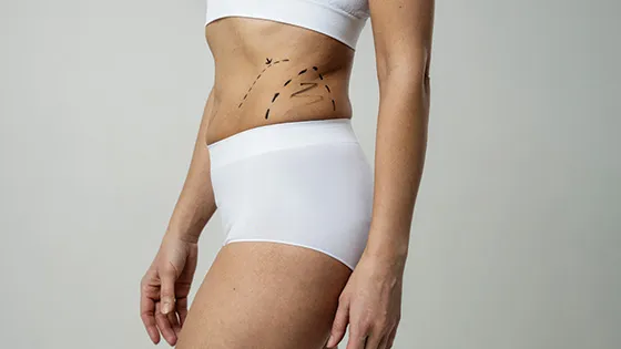 Revitalize Sua Pele com Microagulhamento Corporal