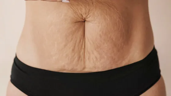 Pele Firme, Sem Rugas e com Colágeno Ativo