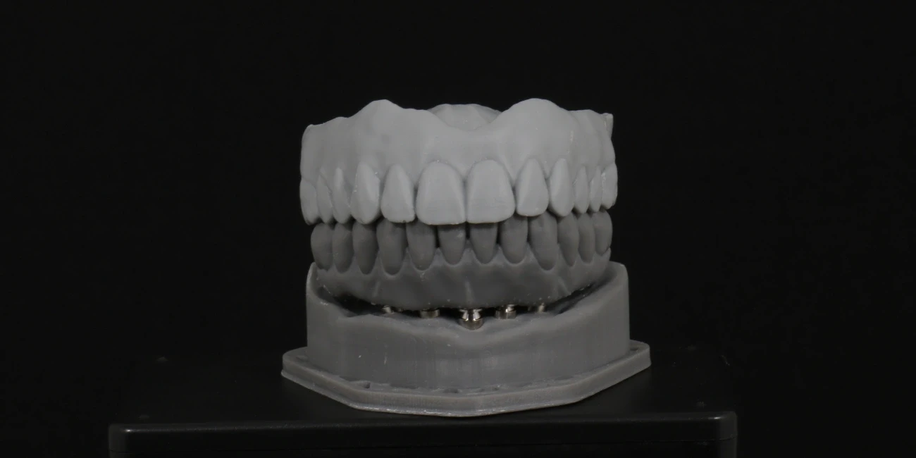 Bruxismo: Causas, Sintomas e Tratamento no SPA Rita Trindade