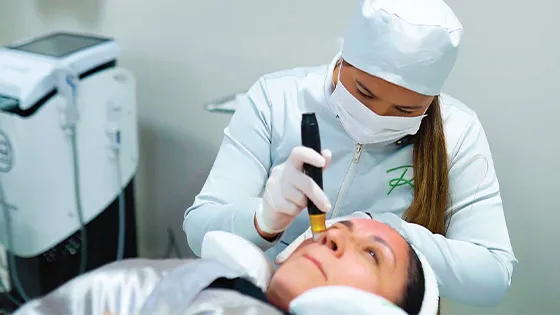 Revitalize Sua Pele com Microagulhamento Facial